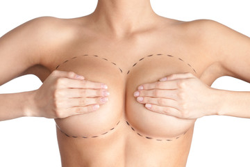Le lipofilling mammaire